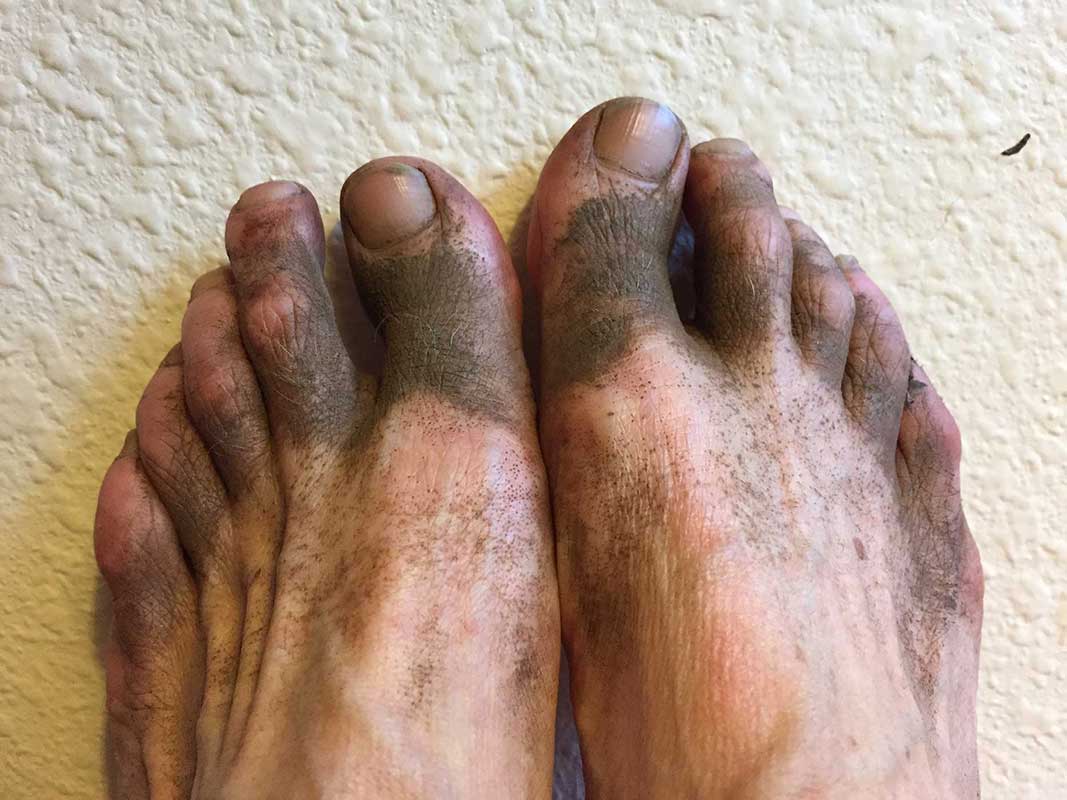 Photo of dirty feet